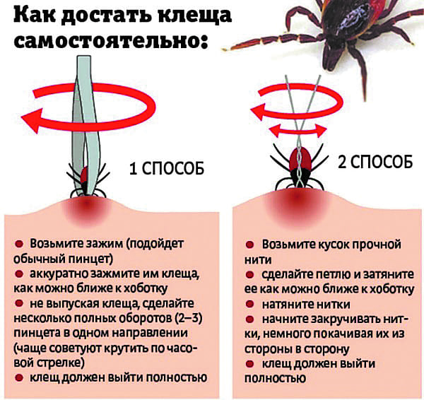 Как правильно достать клеща. Новости Днепра