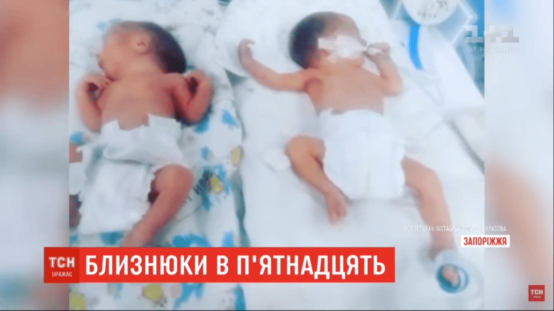 9-классница родила близнецов без хирургического вмешательства. Новости Днепра