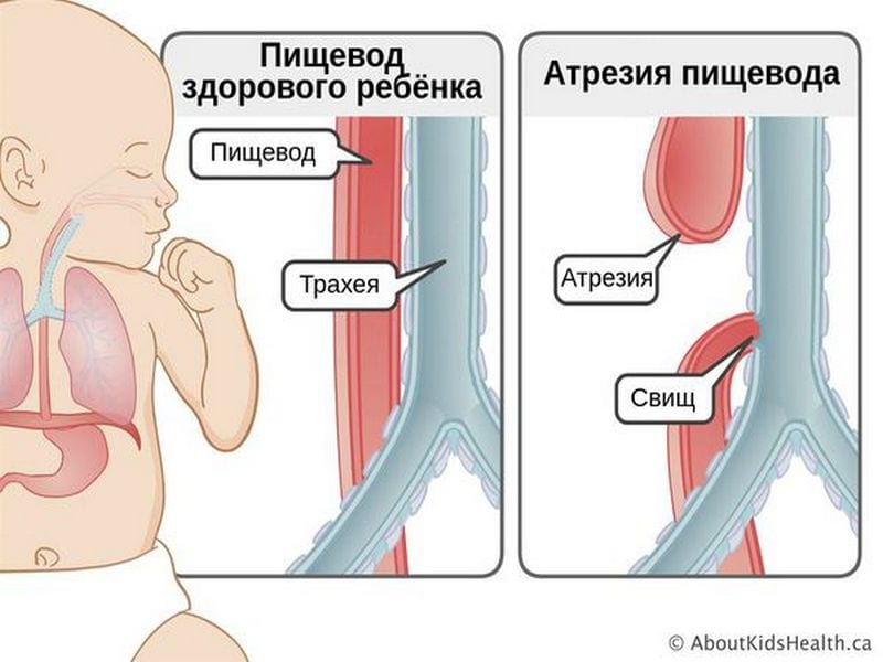 В Днепре провели операцию новорожденному. Новости Днепра