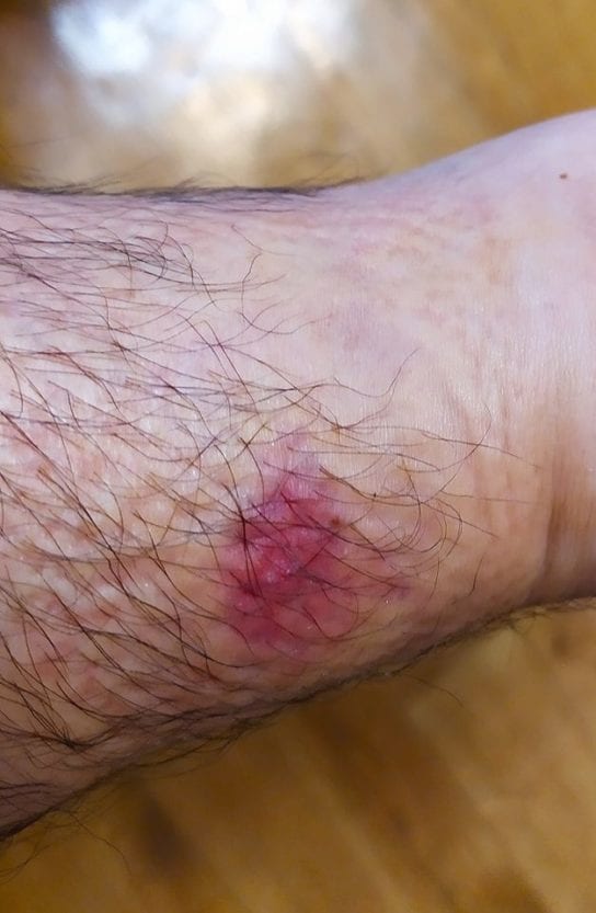 Под Днепром людей атакует страшная мошкара. Новости Днепра