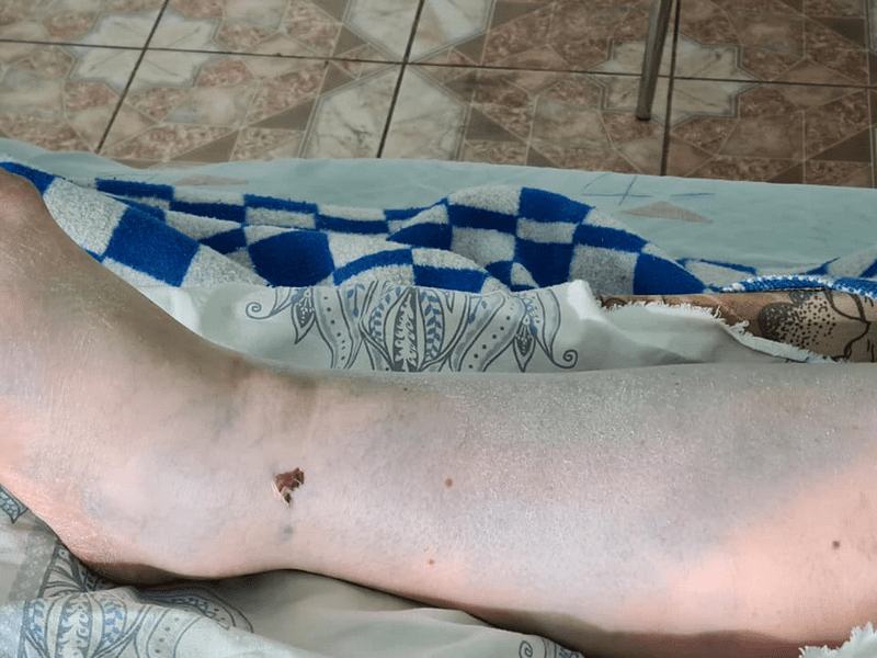 Под Днепром маршрутка переехала ногу женщине – новости Днепра