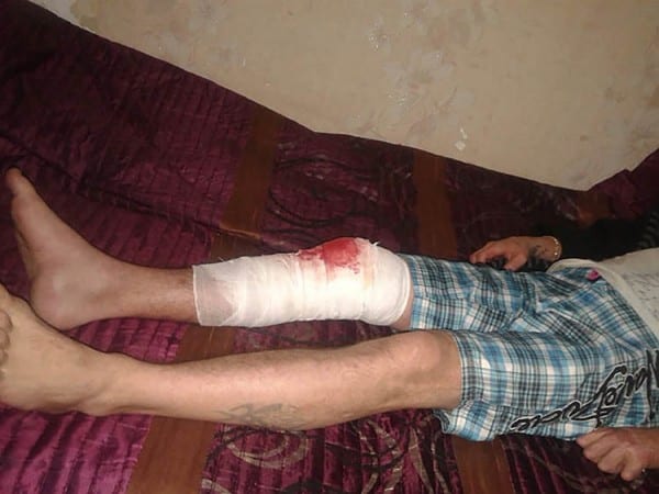 Нужна помощь мужчине с лицом Фредди Крюгера – новости Днепра