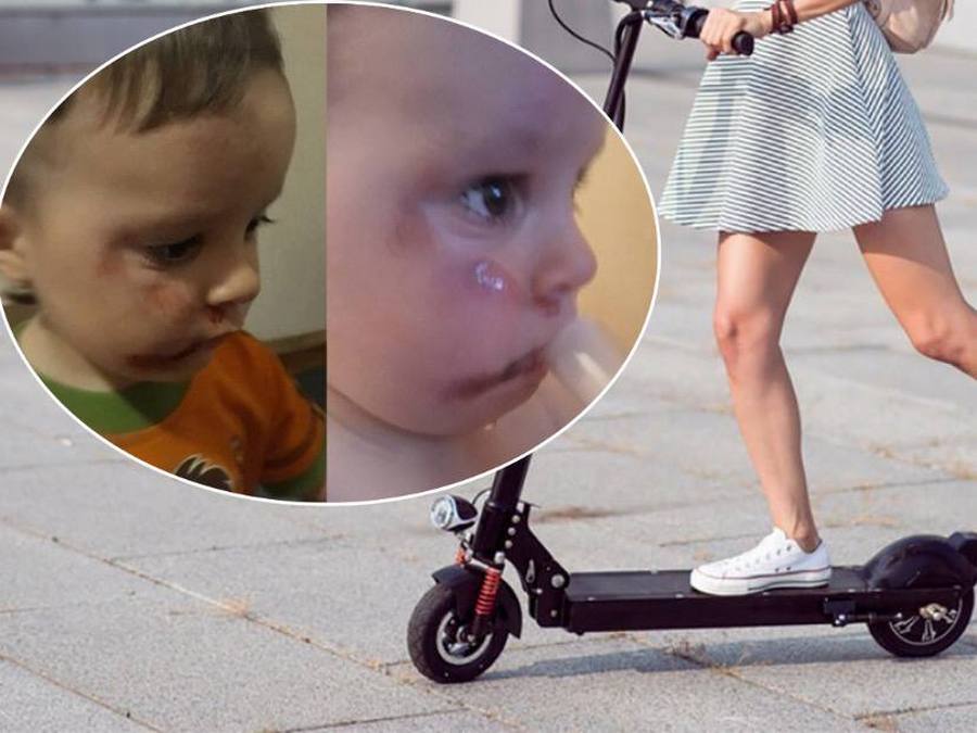 Как чувствует себя 2-летний ребёнок, которого сбили электросамокатом – новости Днепра