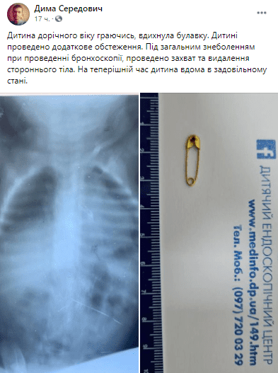 Врачи спасли ребенка, который вдохнул булавку - новости Днепра