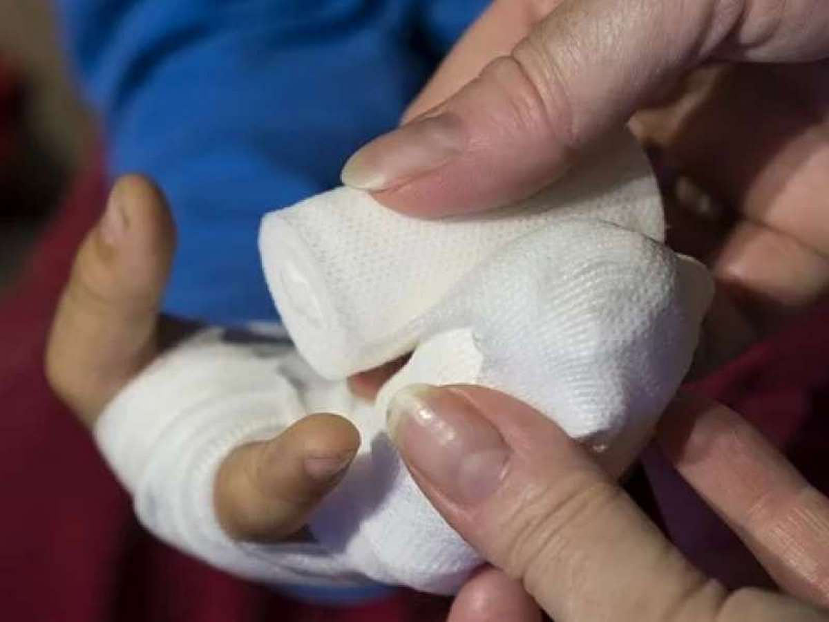 Мужчине петардой оторвало палец - новости Днепра
