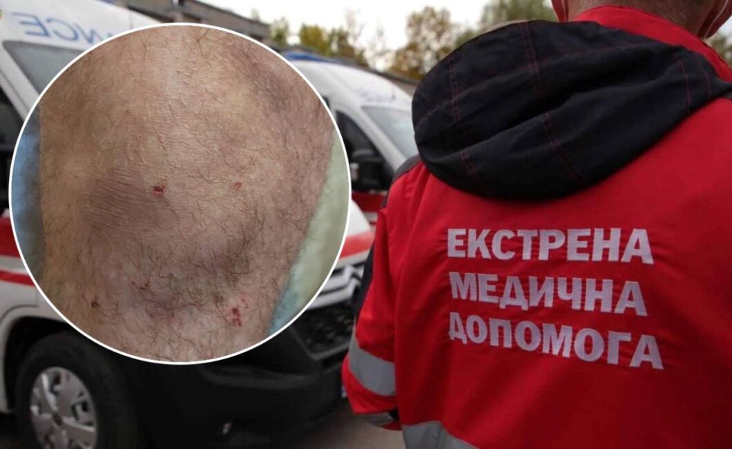 Під Дніпром п’яні пацієнти побили лікаря швидкої - Наше Місто
