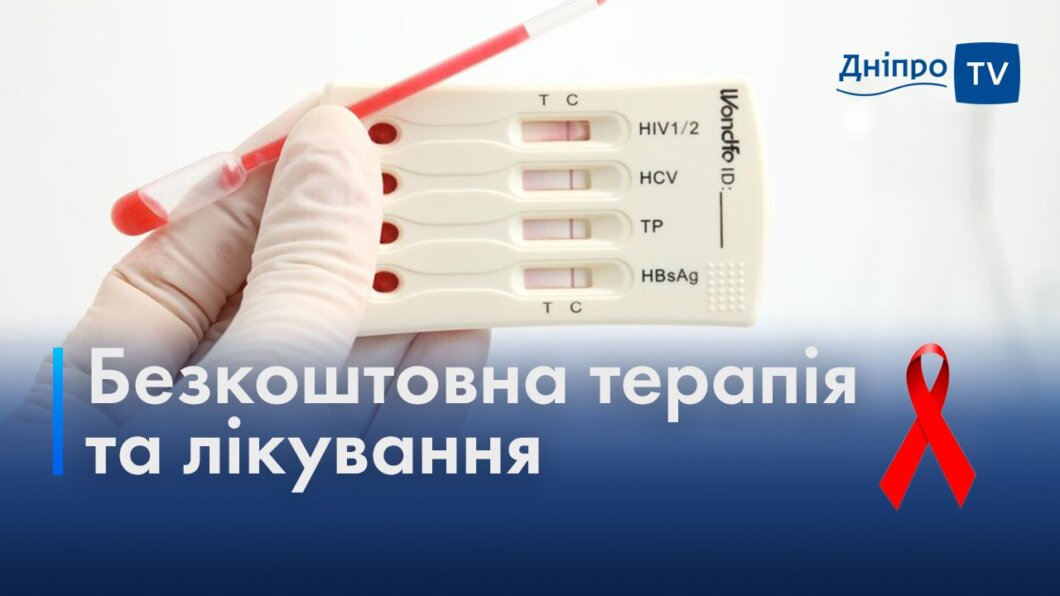 Боротьба зі СНІДом: як у Дніпрі відбувається терапія та лікування ВІЛ-інфікованих